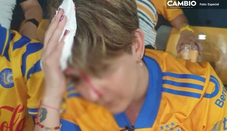 Aficionada de Tigres resulta lesionada por pedazo del estadio que le cayó en la cabeza (VIDEO)