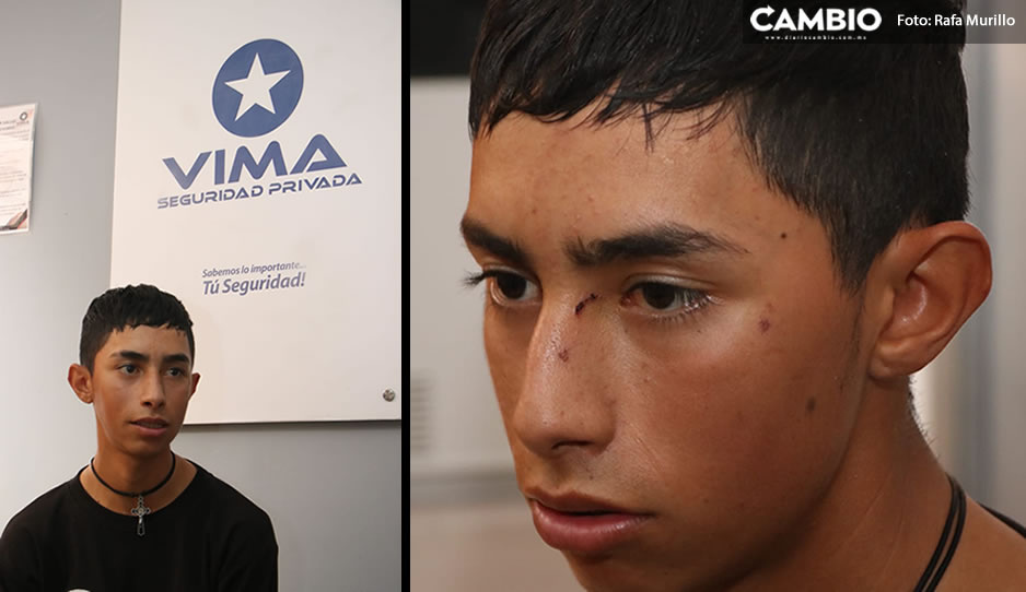 Jonathan narra cómo fue la golpiza que recibió del mirrey; tiene lesiones en ojo, espalda y nuca (VIDEO)