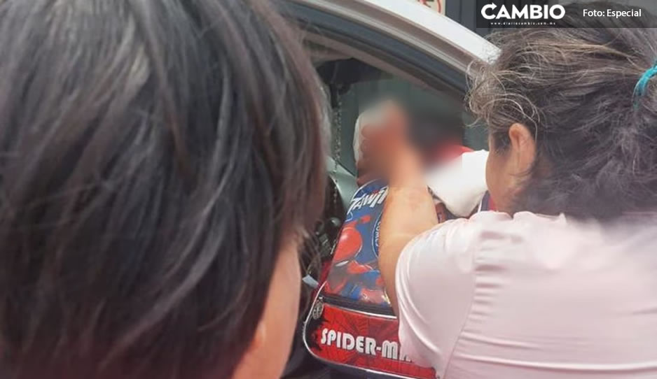 Perro pitbull ataca a niñito de 5 años; le destroza el rostro y la cabeza