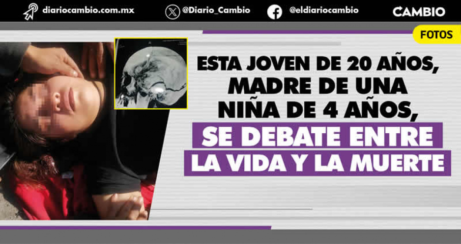 Tras ser arrollada en la 11 sur, Xiclali lleva 10 días en coma