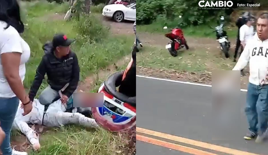 FUERTE VIDEO: Motociclista pierde su pie por manejar a exceso de velocidad