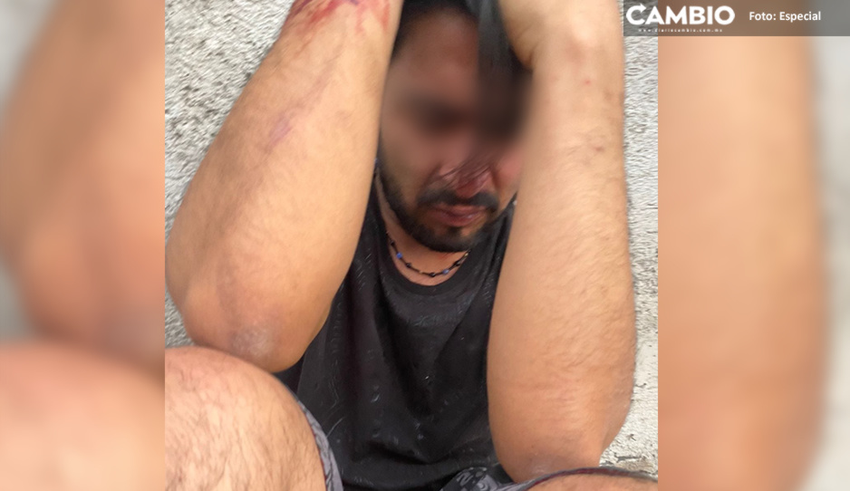 Justicieros dan tremenda golpiza a ladrón por robar en centro de salud de Chachapa