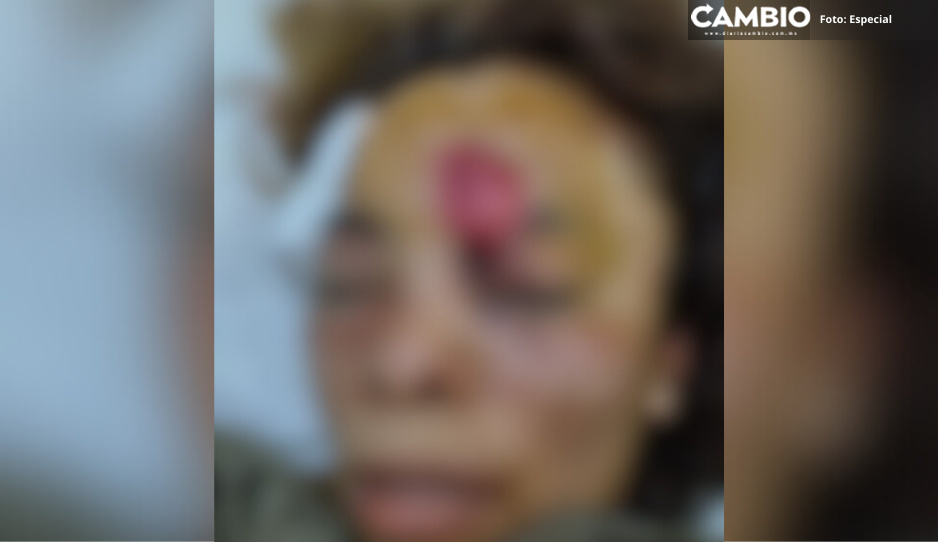 Golpean brutalmente a mujer en pleno baile en Ocoyucan; está grave