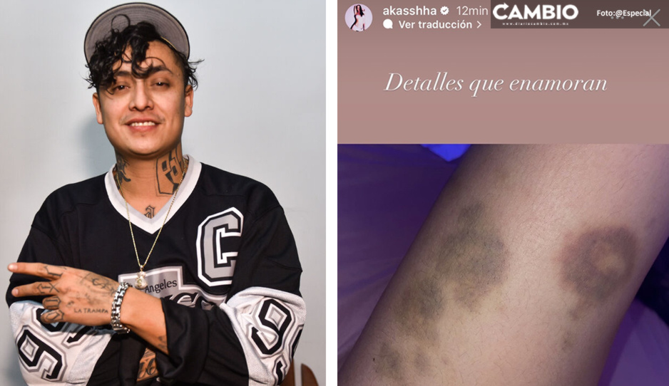 Alemán es señalado de violencia física por su novia Akasha (FOTOS)