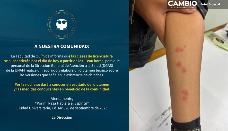 Facultad de Química de la UNAM suspende actividades por plaga de chinches