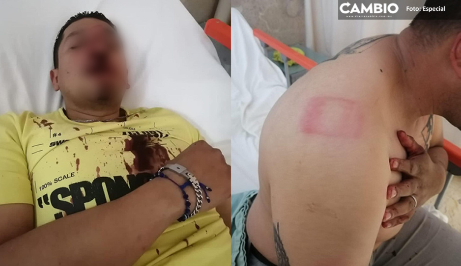 Nutrióloga del IMSS La Margarita golpea brutalmente a su novio por terminar la relación