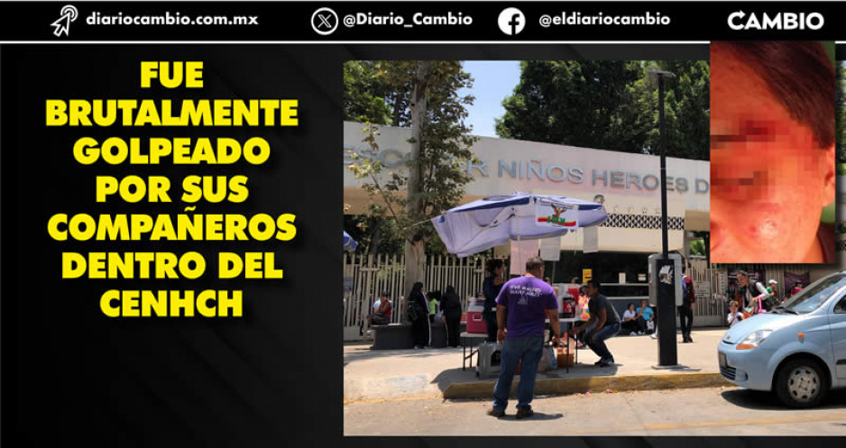 Estudiante de la prepa del CENHCH tiene una perforación en su ojo tras la golpiza