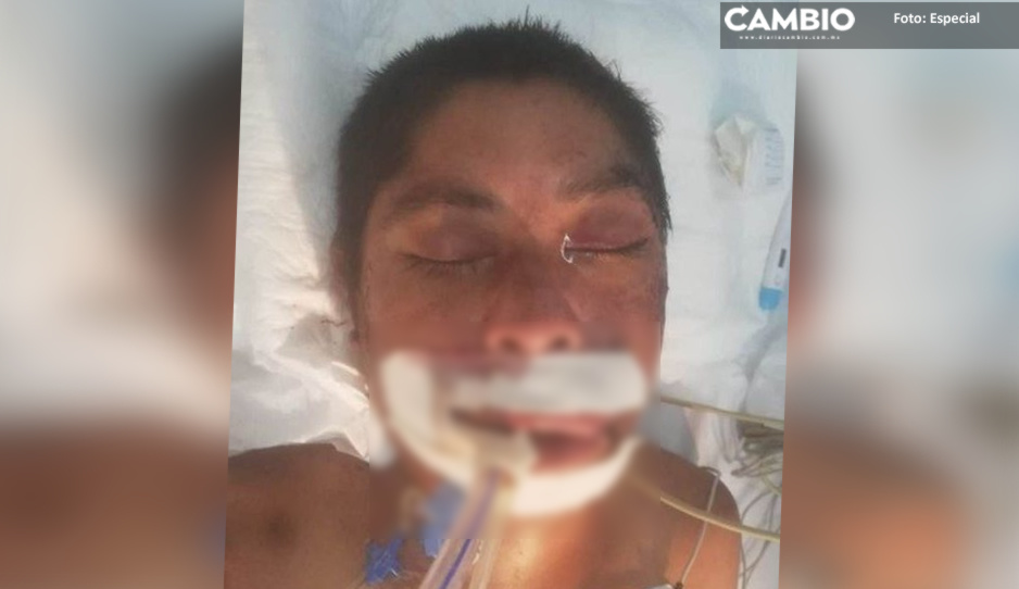 Buscan a familiares de joven encontrado herido en Huixcolotla