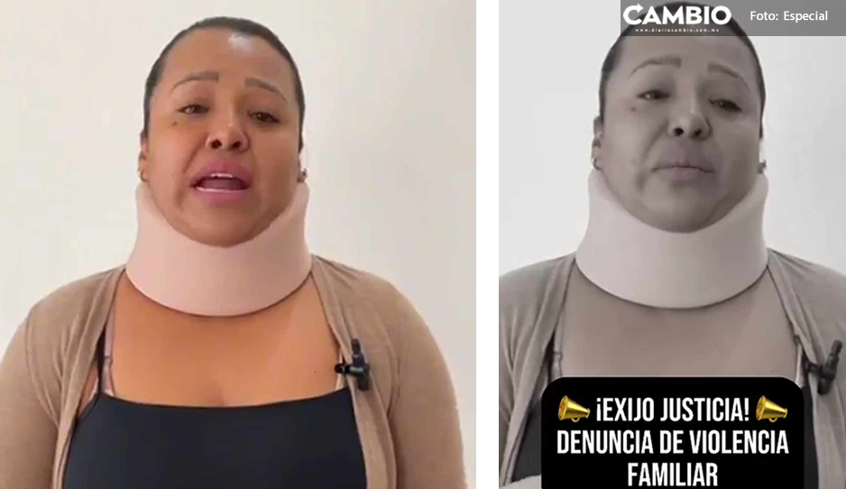 Monserrat Gutiérrez pide a la FGE seguridad tras liberación de su expareja que intentó matarla (VIDEO)