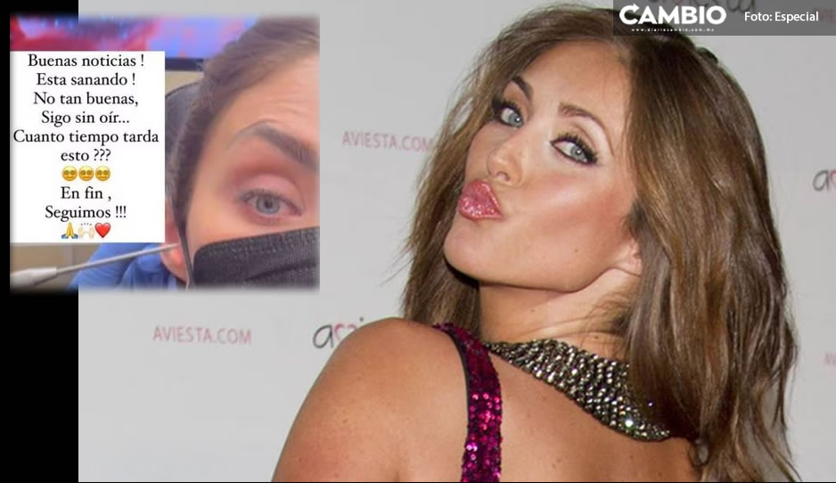 `Sigo sin oír´ Anahí habla sobre la salud de su oído a un mes de arrancar gira de RBD