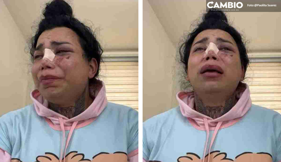 Paola Suárez rompe el silencio en VIDEO: “Lo que más duele es el golpe en el corazón”