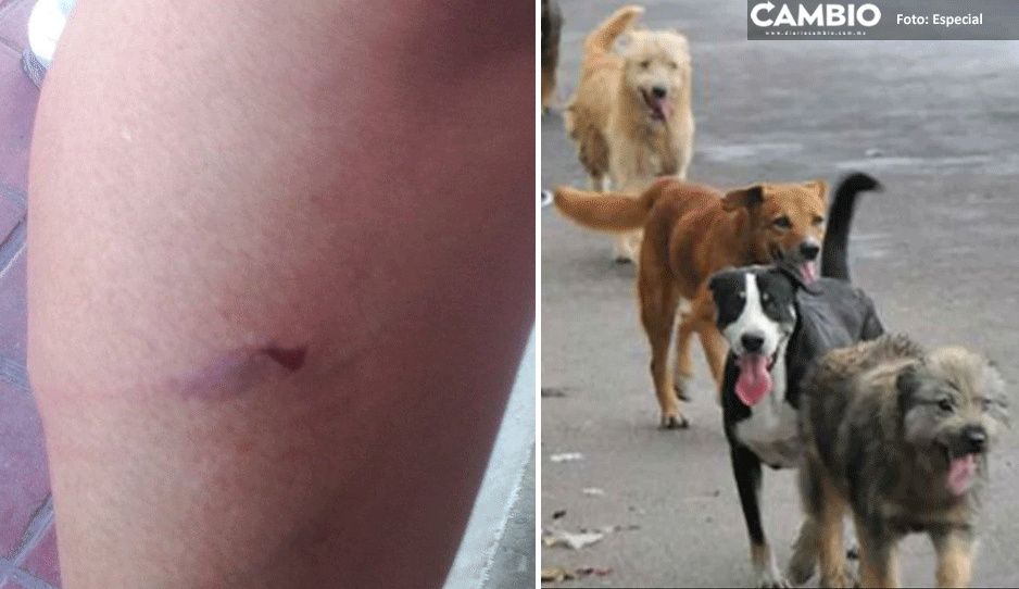 Peligrosa jauría de perros callejeros sigue atacando en Izúcar