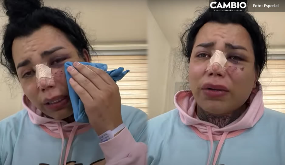 ¡Amiga, date cuenta! Paola Suárez revela que aún quiere a su novio pese a que la golpeó (VIDEO)
