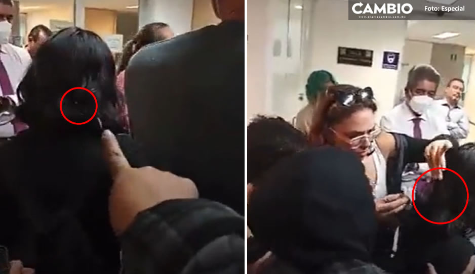 VIDEO: ¡Qué miedo! Captan &quot;chinches&quot; en cabello de alumna de Ciencias Políticas de la UNAM