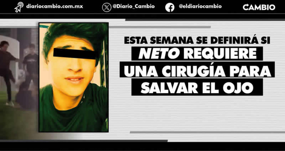No solo es su ojo: Neto Calderón presenta lesión en la columna tras brutal golpiza en la Estrella de Puebla