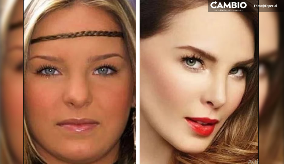 VIDEO: Cirujana revela por qué Belinda tiene prohibido engordar