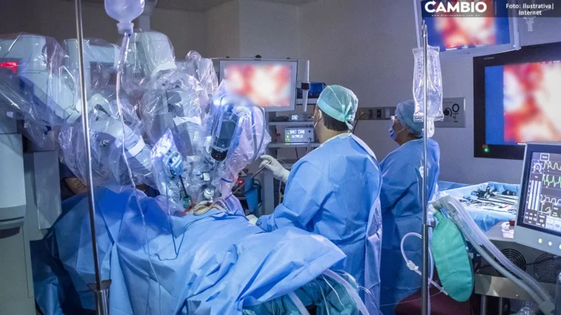 ¡Se moderniza la cirugía en Puebla! Llega “Da Vinci”, robot quirúrgico al Hospital Ángeles