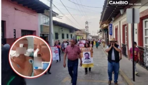 Realizan marcha para exigir justicia por Braulio, reo asesinado por policías en Zacapoaxtla