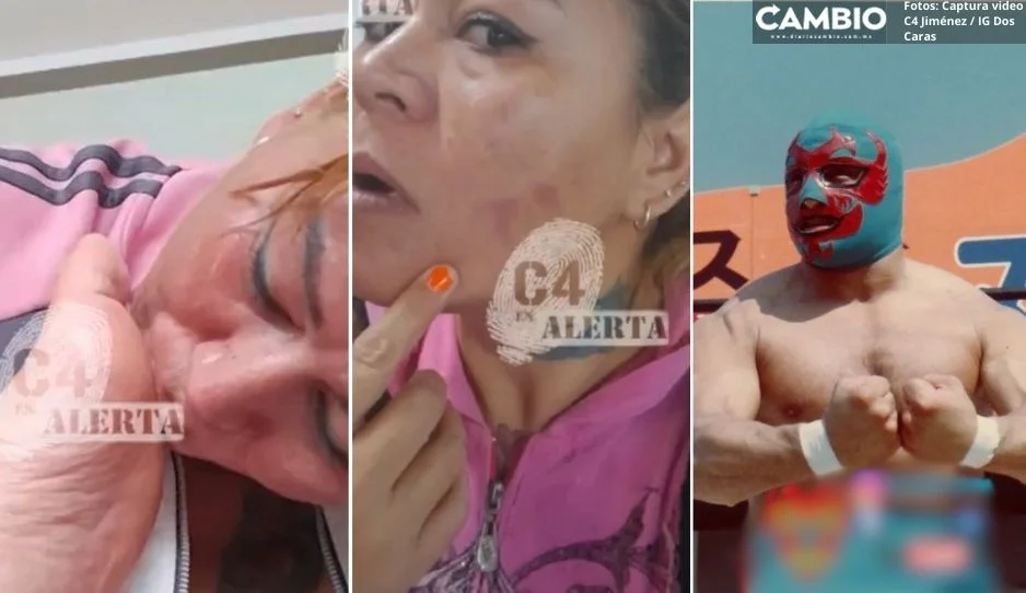 VIDEO: Expareja acusa a Dos Caras de golpearla y mandarla a quemar con ácido