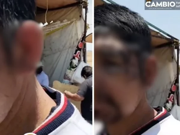 Campesino narra golpiza de policías tras confundirlo con opositor del relleno sanitario de Cholula (VIDEO)